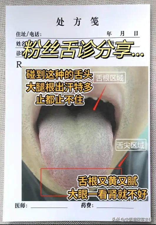 粉丝舌诊案例合集，抽空看舌象！