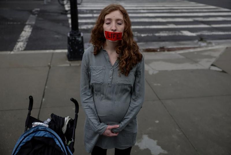 美国这起事件简直让人三观震碎！32岁的外科医师阿巴斯，在女友怀孕后要求其堕胎遭拒