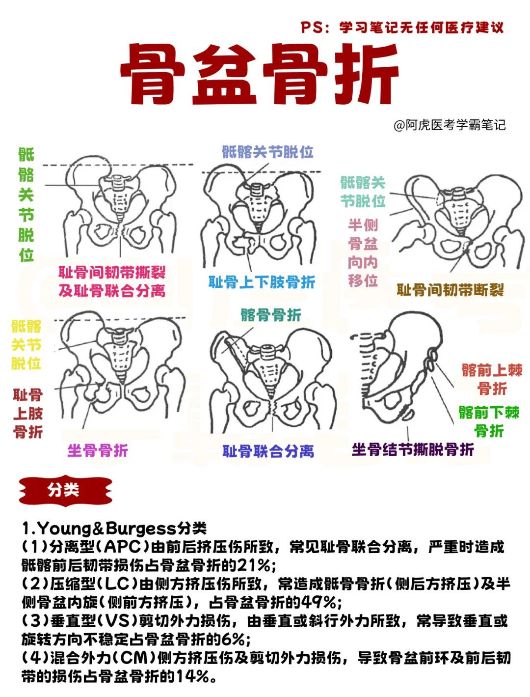 医学生笔记📒｜骨盆骨折👆