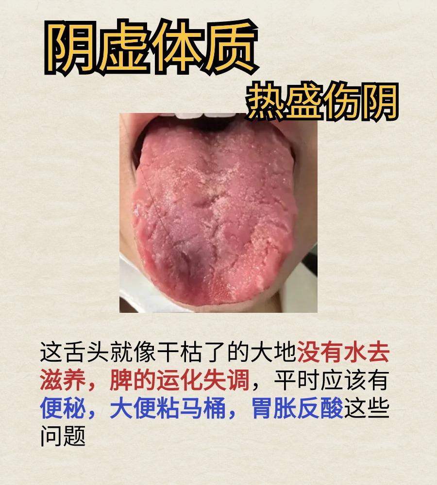 中医舌诊看病！