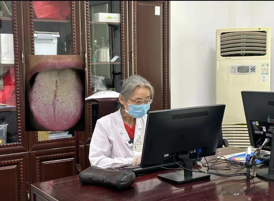 今天分享一位粉丝朋友的舌诊图。

主诉：尿频尿急，尿的颜色发黄；食欲不振，腹胀。