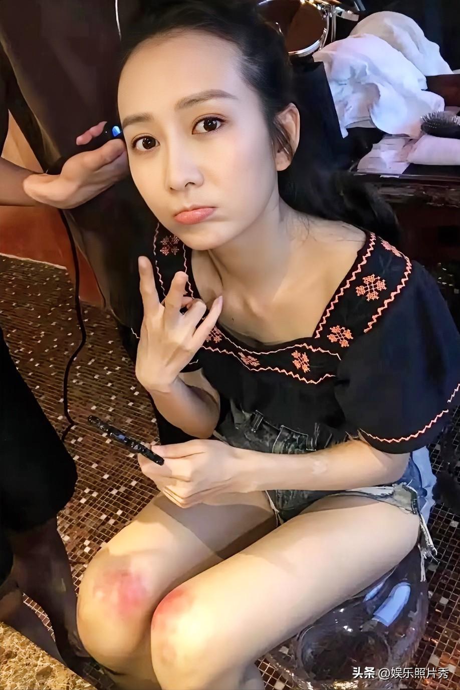 在女演员里，她论颜值，论演技都是“准一线”水平的！

这俩膝盖让人看着“心疼”！