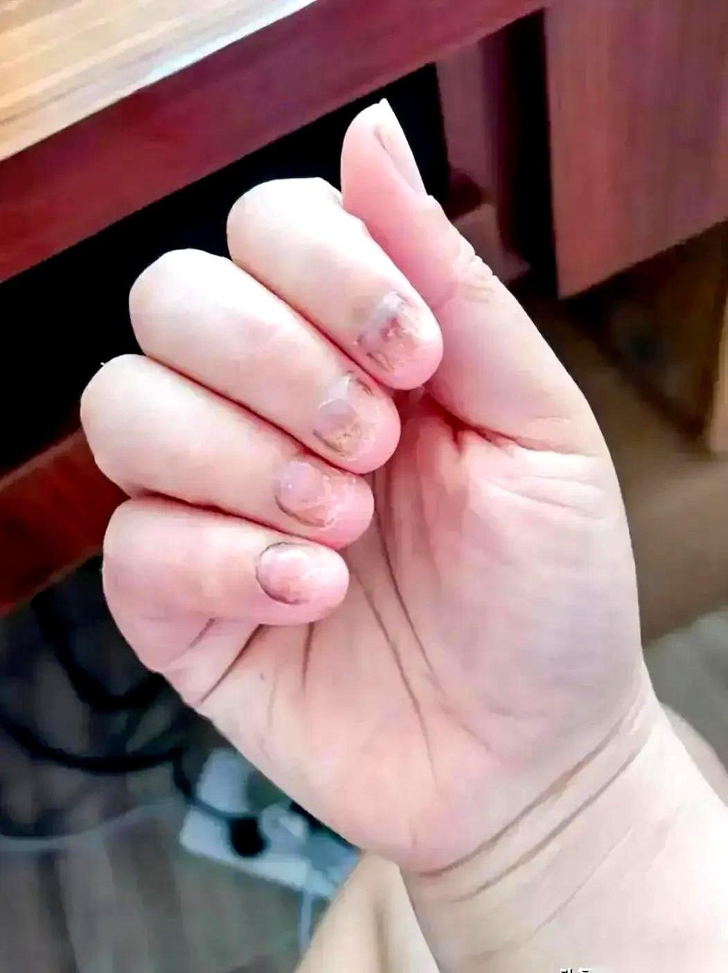 297块钱，就那么一丁点儿，5毫升。
还不能走医保。
为了抱我那还没出生的外孙，