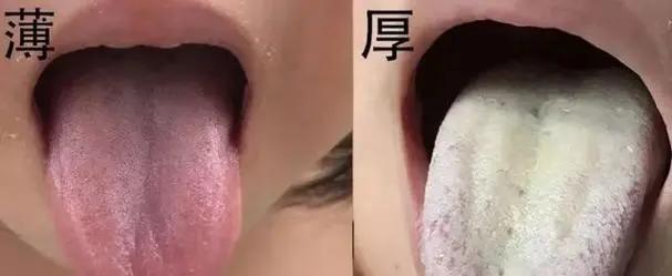 肾主水，体内湿浊太多，对肾有影响。
湿是阴邪，其性重着、粘腻，容易和寒热结合，寒