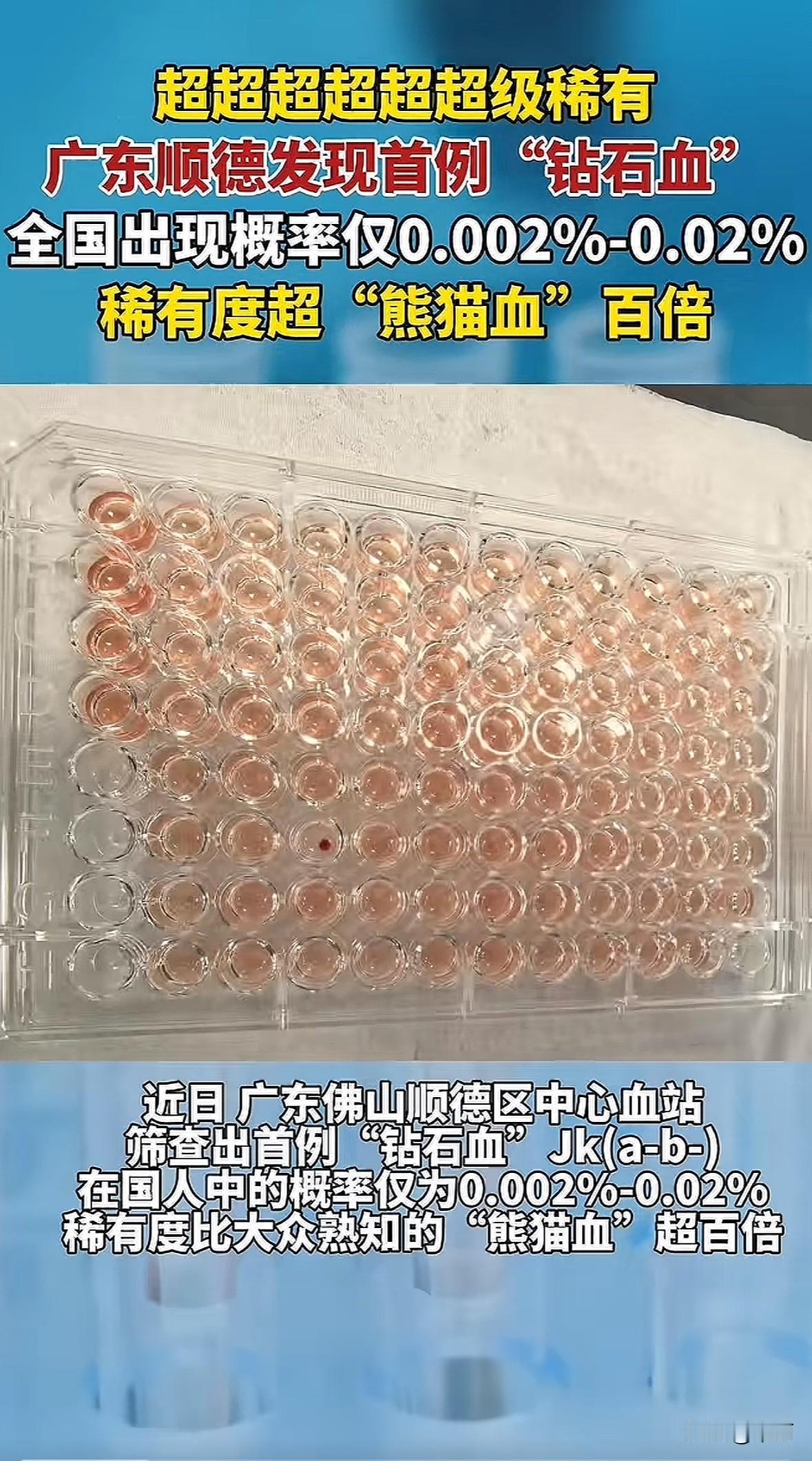 广东顺德中心血站最近筛查出首例“钻石血”，学名叫Jk(a-b-)，这是2024年