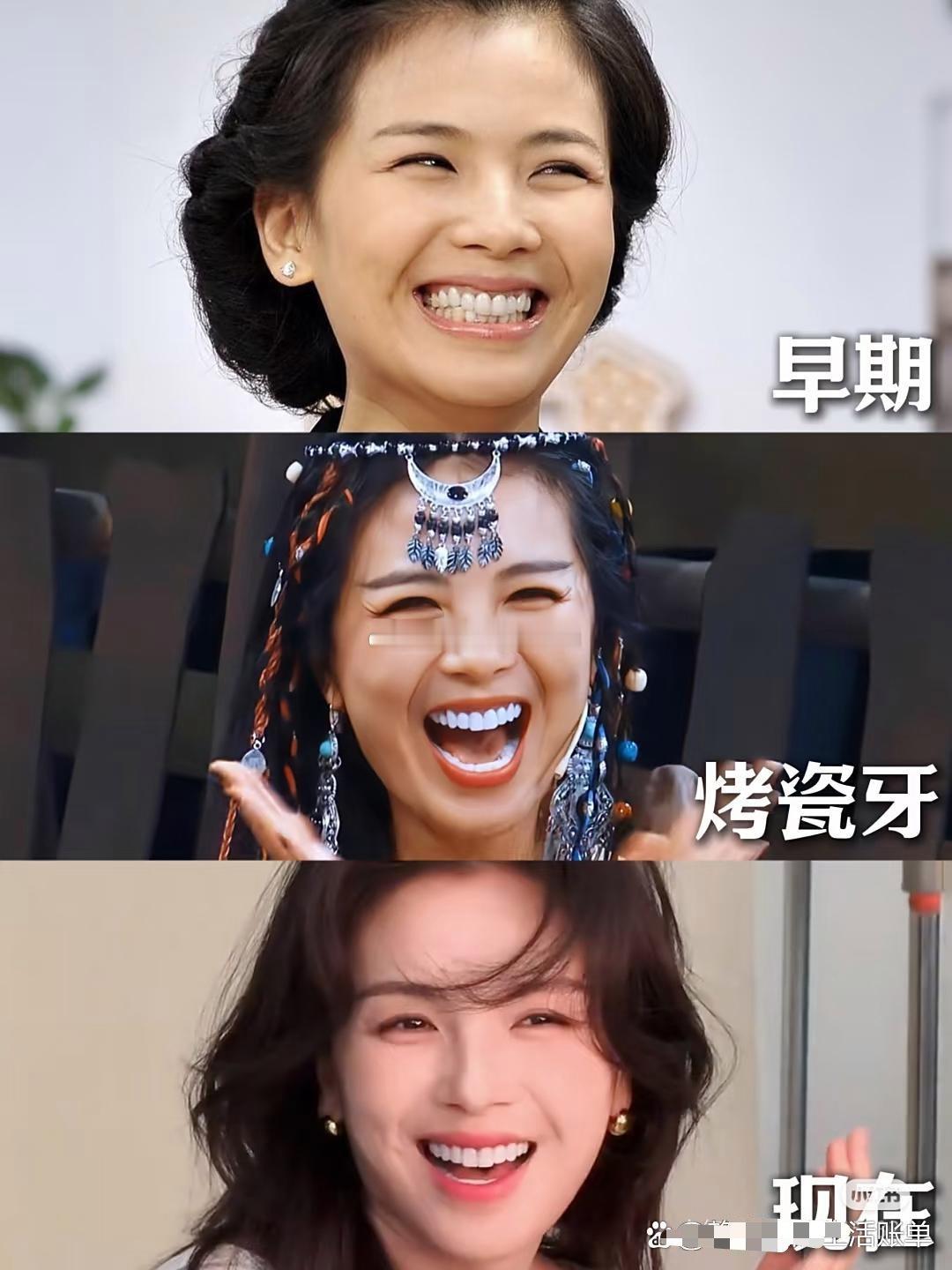 据说刘涛这一口牙花了三百万，到底值不值？ ​​​