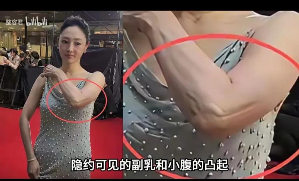 才四十出头的白百何，都老成了这样子，脸上脖子手臂的皮肤都垮塌了。
她是经厉了什么