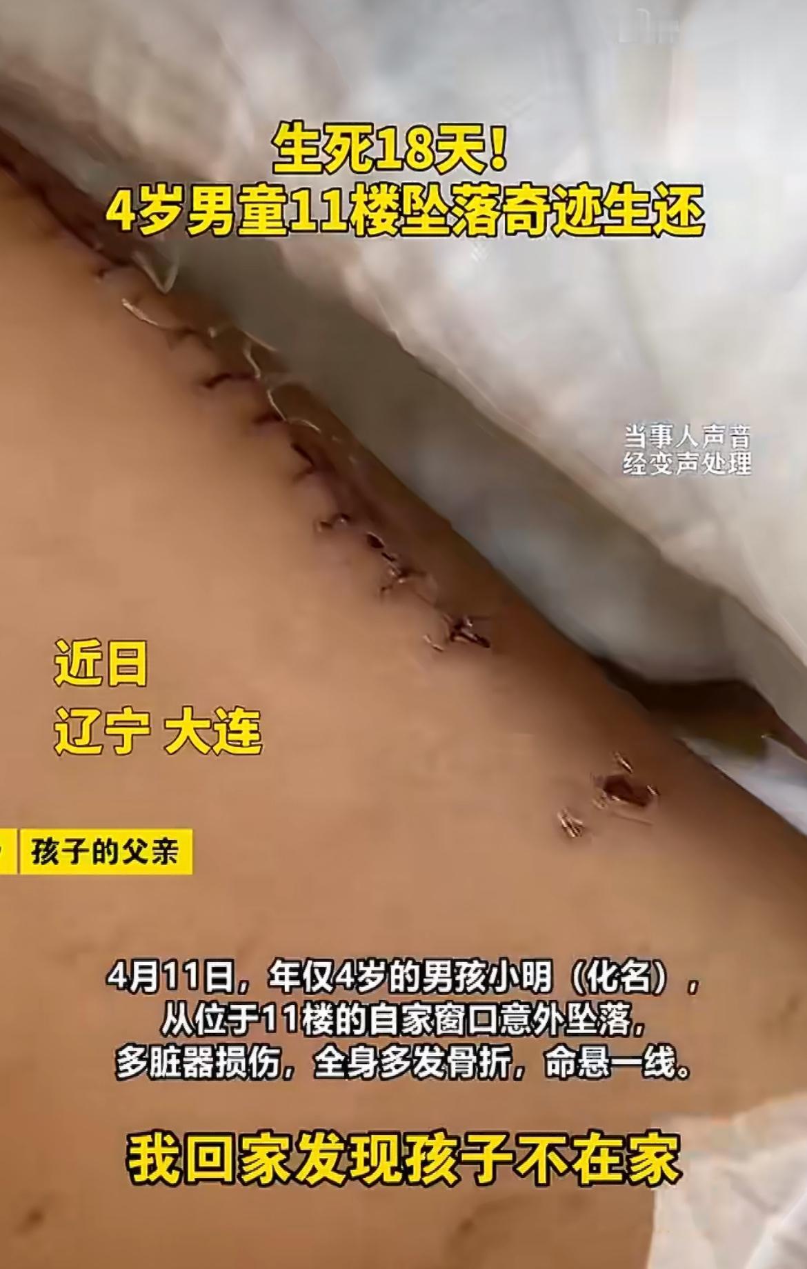 “福大命大！”4岁男童从11楼掉下来，医生一开始说存活率只有5%，结果居然熬了1
