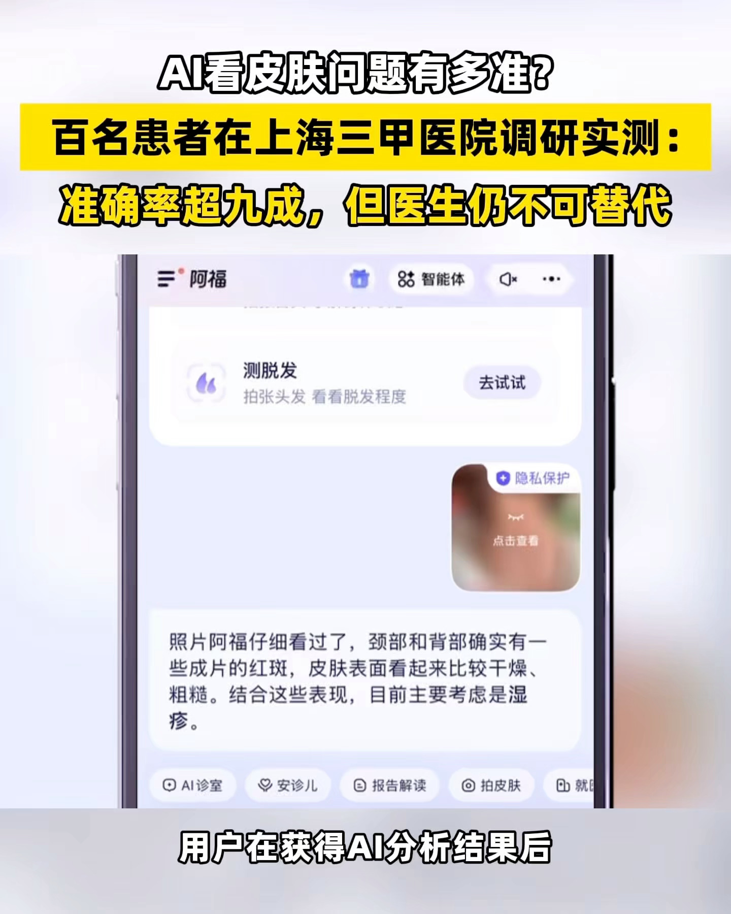 得了皮肤病一定不要自以为是 别再自己当医生了。AI看皮肤病91%的人都说准，还有