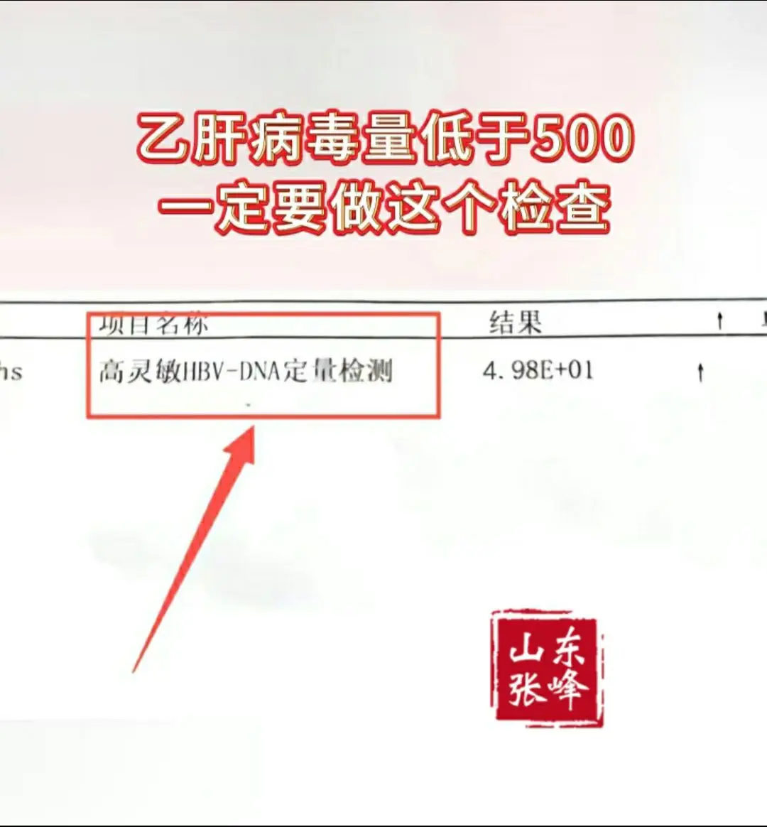 乙肝病毒量低于500一定要做这个检查！