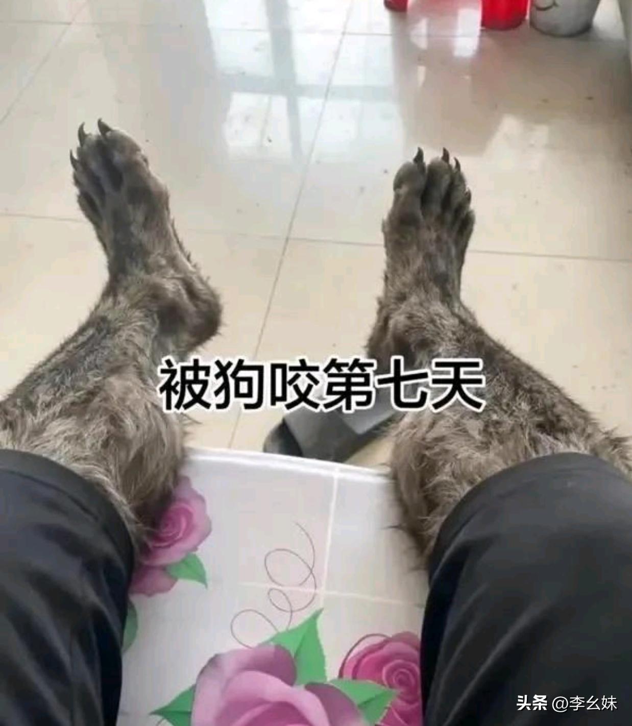 被狗咬第七天了，怎么办家人们？