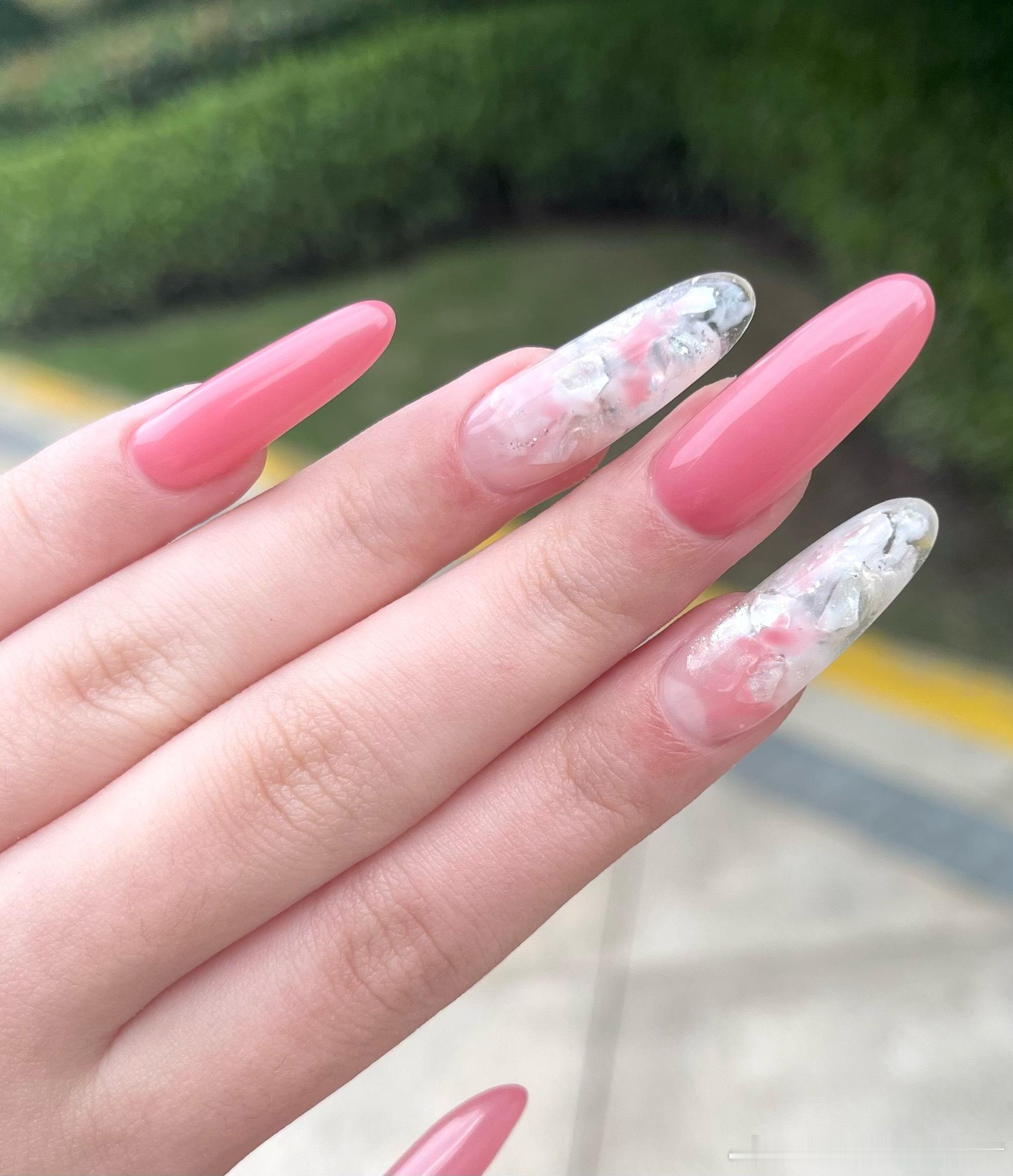 💅🏻34197【江坂丽奈】+醋酸美绝了、、这甚至还是阳光下无滤镜 