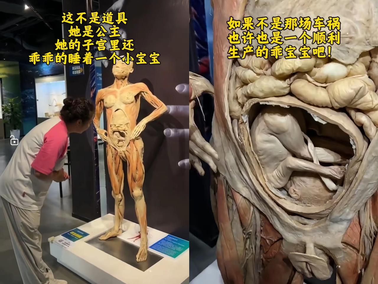 刷到有人打卡人体博物馆，那些由真实人体制成的标本一亮相，直接把“生命奥秘”从课本