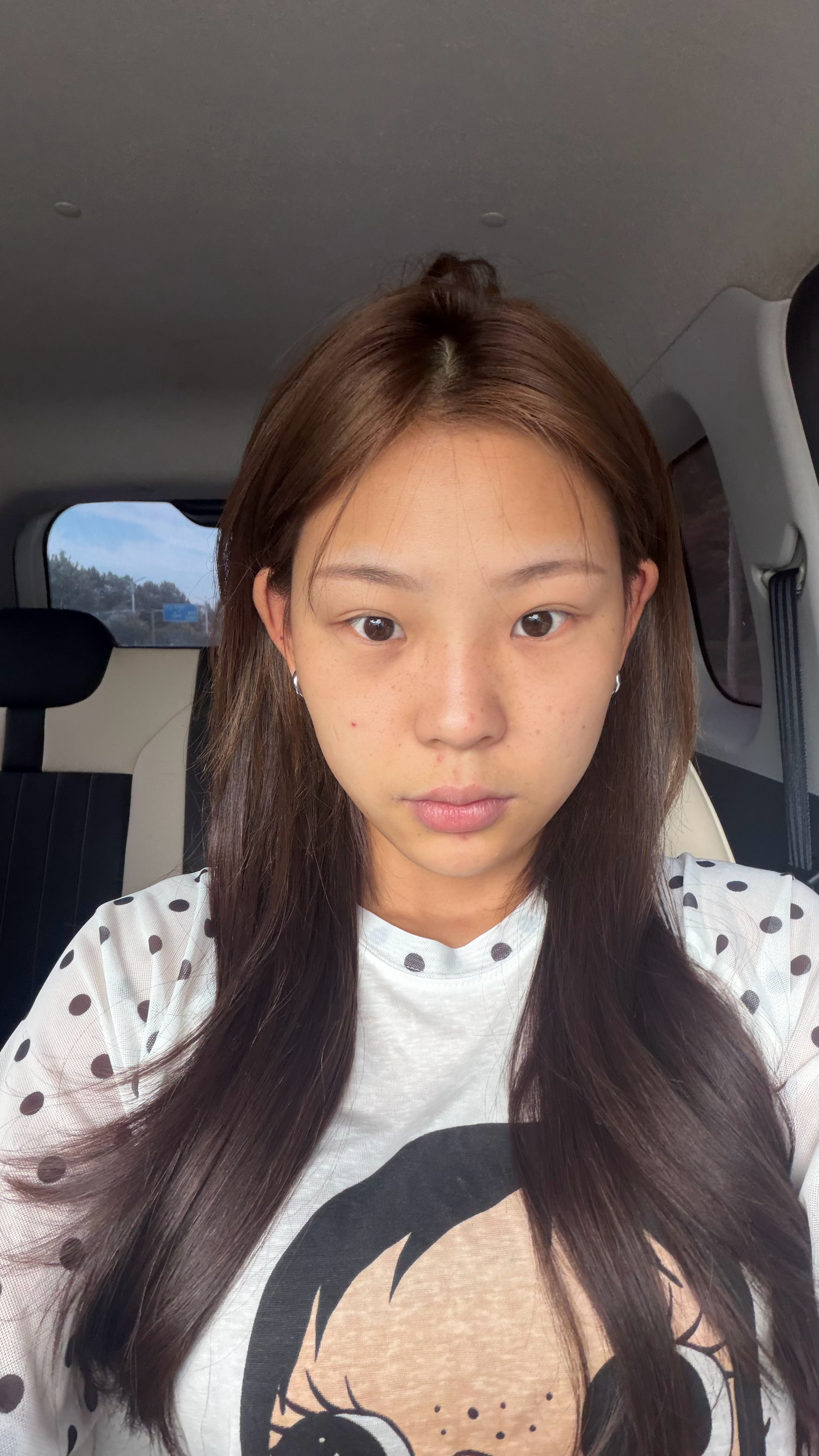 瘦脸针已经奏效但是这两天太重口了 出热气疙瘩了 