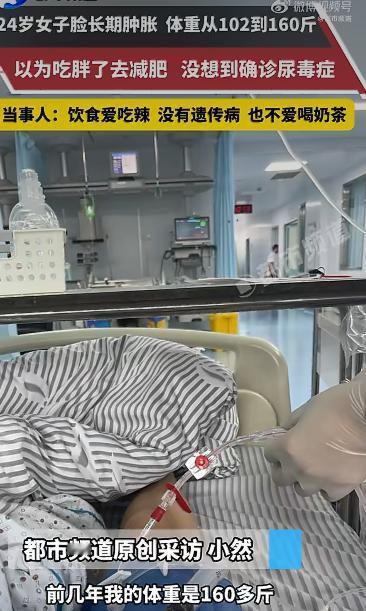 安徽一位24岁姑娘的经历让无数人揪心：她原本体重102斤，半年内突然飙升到160