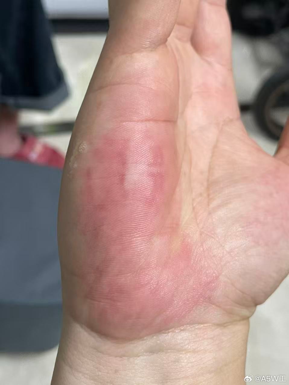 这小家伙，昨天咬我好几口，咬的开心得很，咬自己就不使劲 