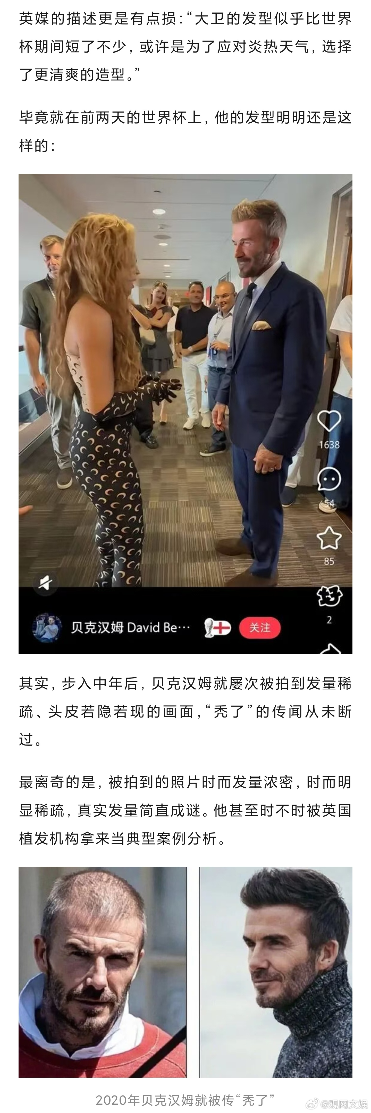 贝克汉姆疑似秃顶贝克汉姆疑似有秃顶家族遗传基因刚刚结束世界杯行程的贝克汉姆，被拍