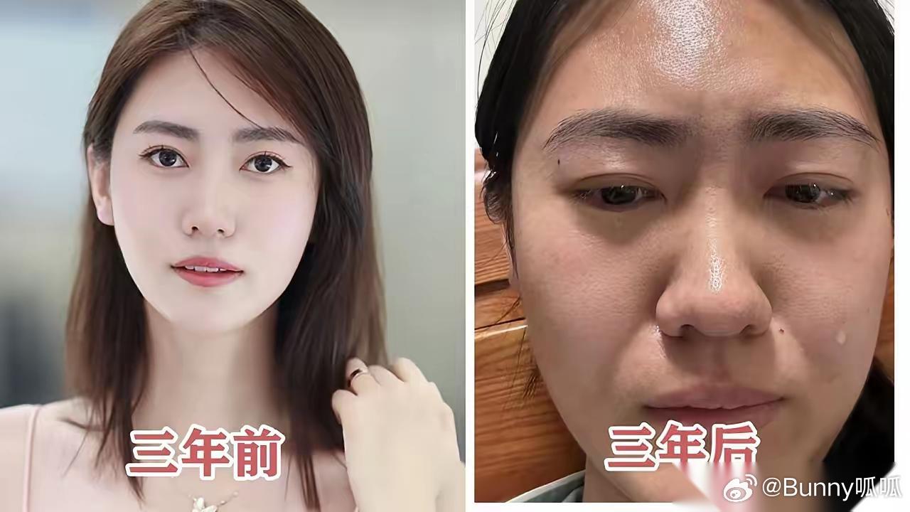 珍珍三年前是什么样子，三年后又是什么样子，有人怪到了胜宏科技张总身上！ 我认为，