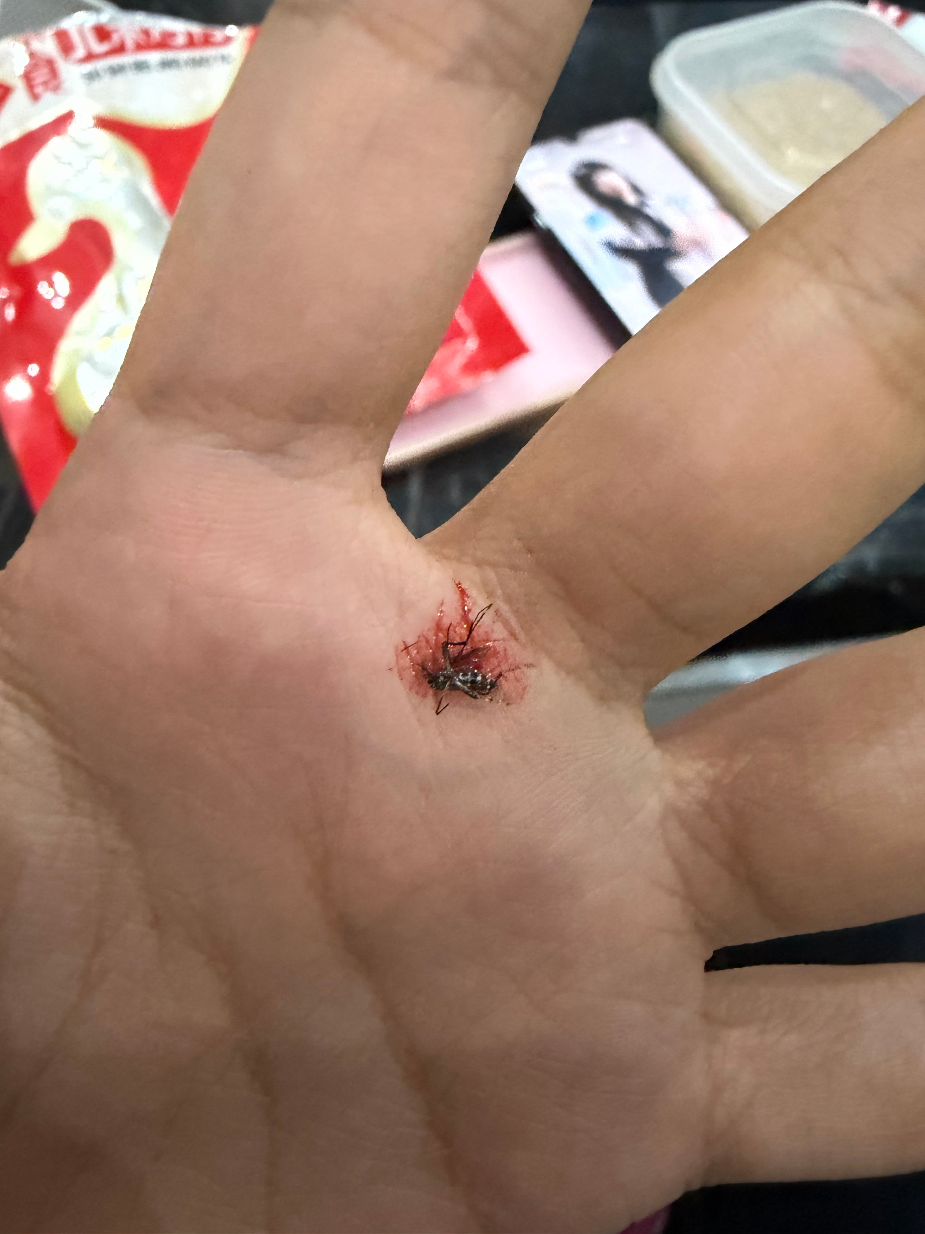 臭蚊子🦟终于让我逮到你了，吸我这么多血