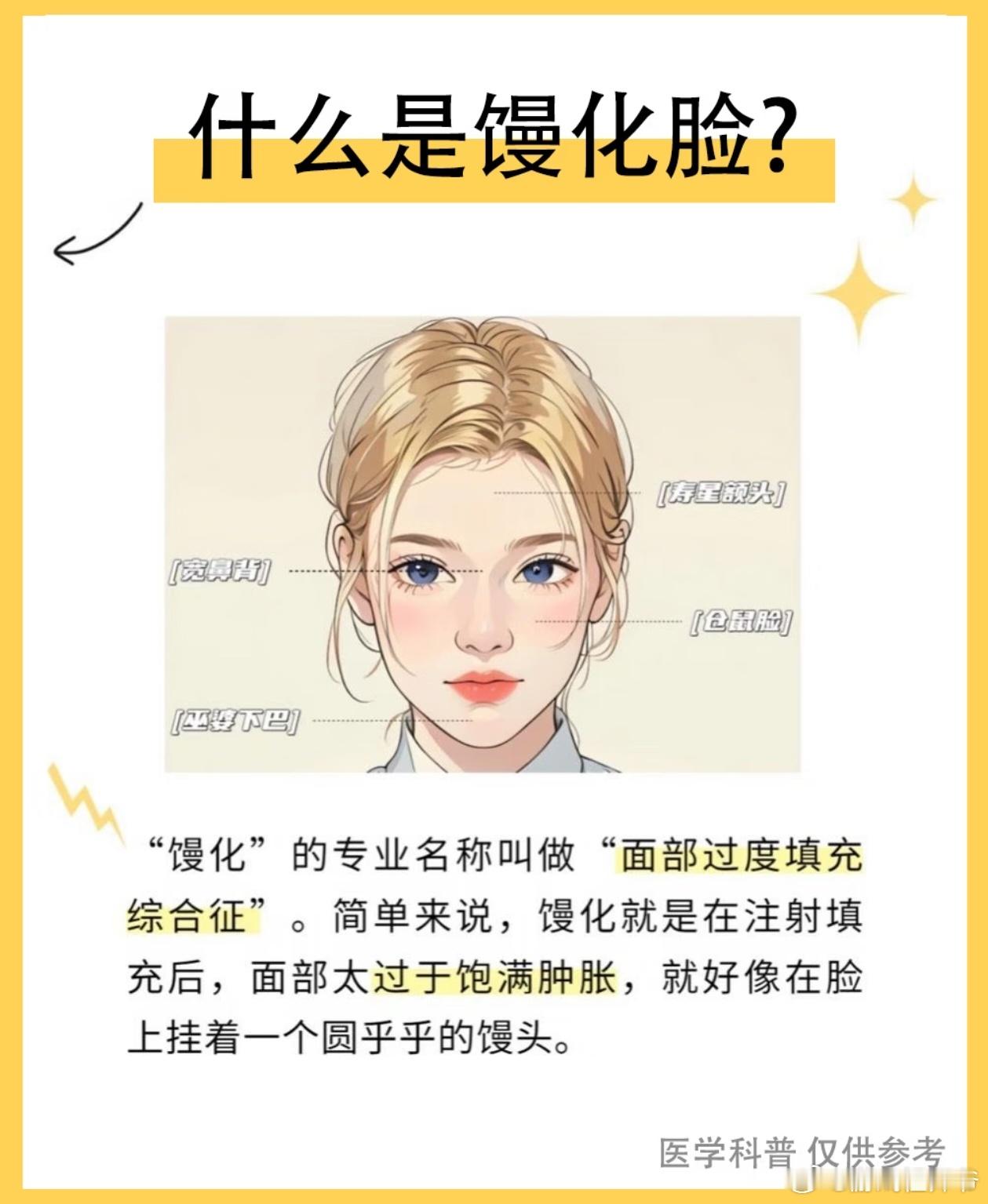 馒化脸是什么馒化脸顾名思义就是医美之后脸浮肿的像充气馒头一样，过度医美还会导致脸