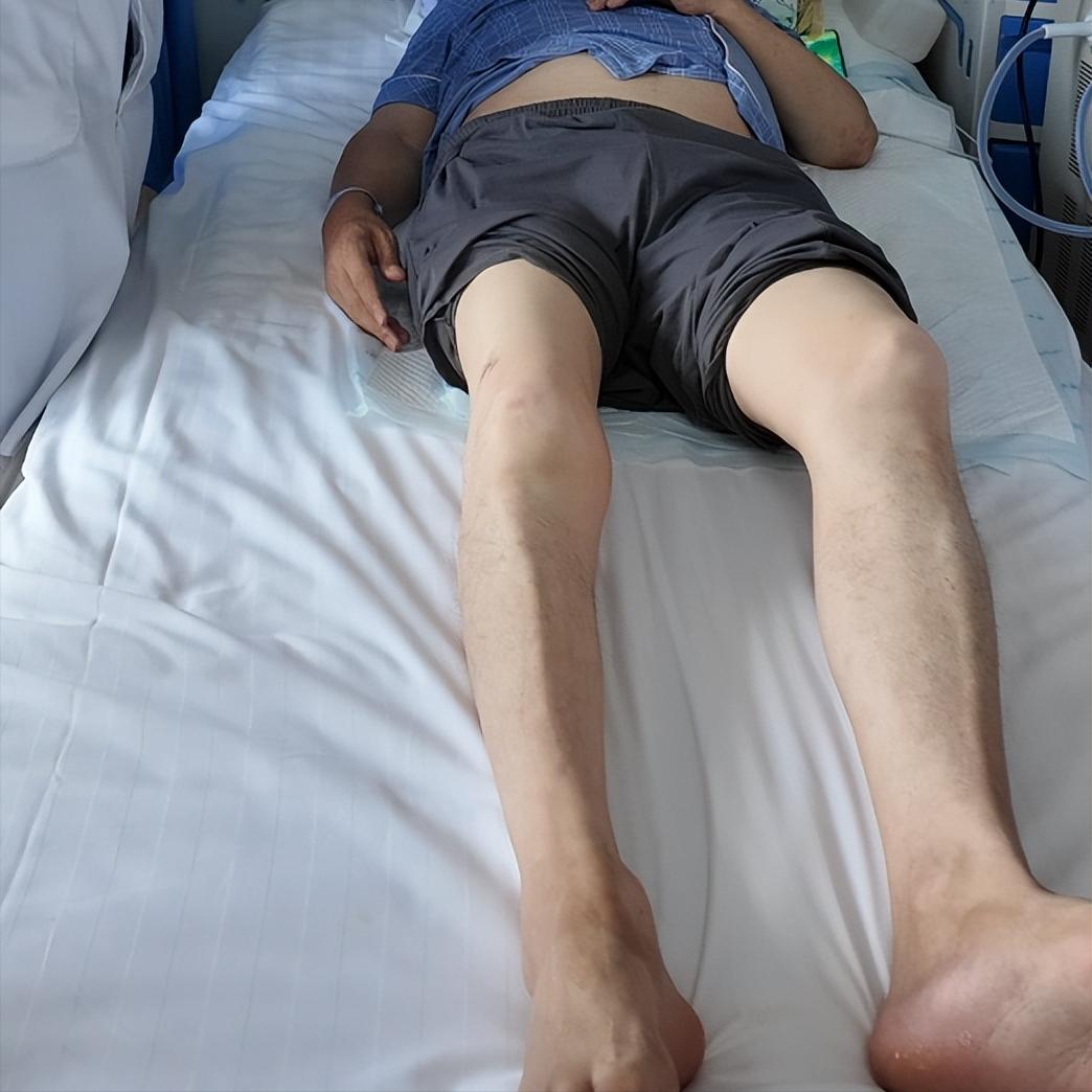 偏瘫，为什么都讲究：能坐不躺，能站不坐

为什么不能躺？
长期卧床，肌肉以惊人的