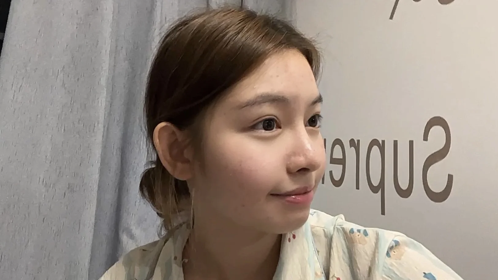 医美真的让我皮肤真的有在变好