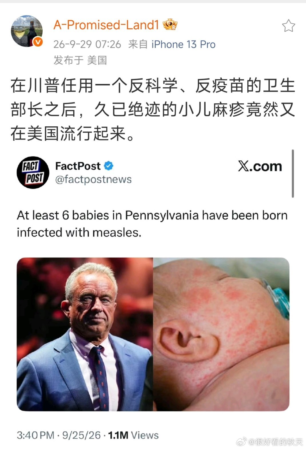 信川普，得麻疹。[吃惊]孩子父母是MAGA吧？ ​​​