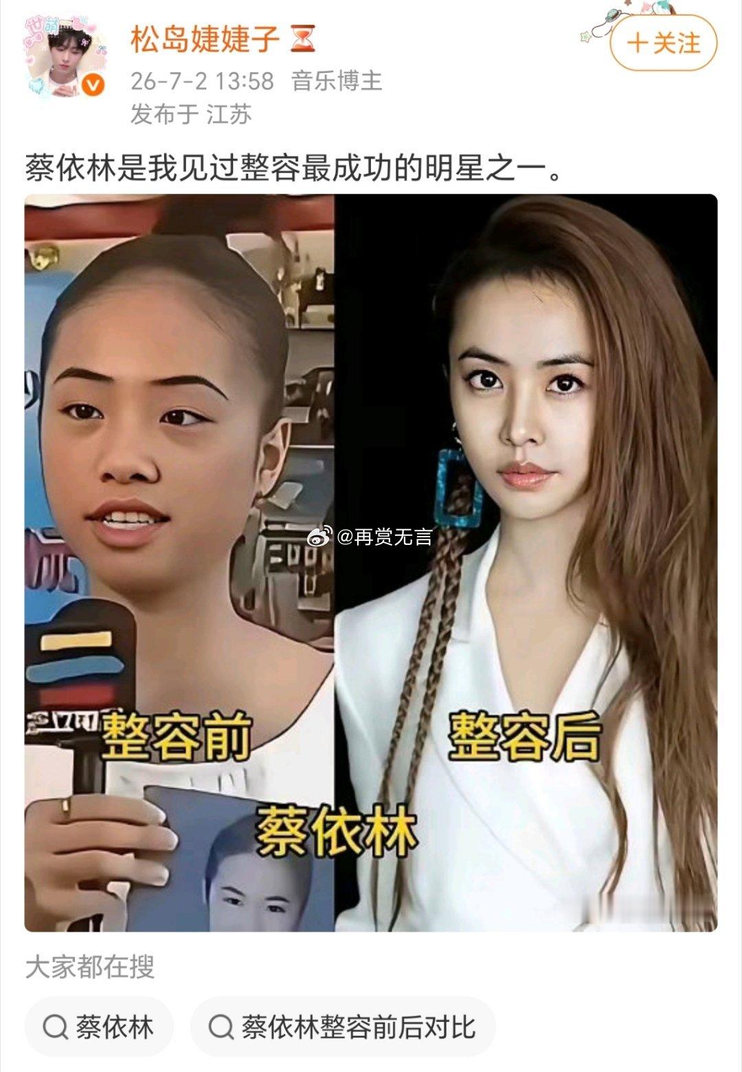 人家只是变瘦了，怎么造谣她整容呢？纯天然女星。 