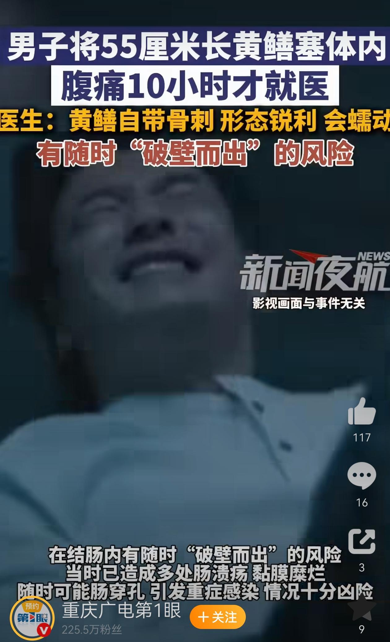 估计是天气炎热，男子下河游泳时黄鳝乘虚而入吧？近日，浙江台州，男子将活体黄鳝塞入