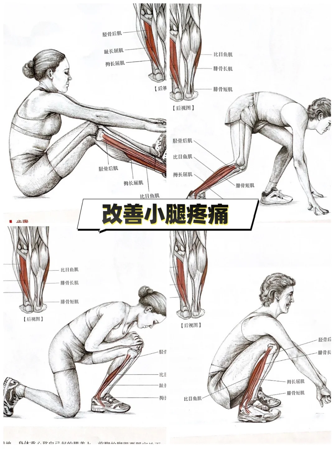 🚨紧急修复小腿拉伤！告别疼痛再跑无忧🏃‍♂️