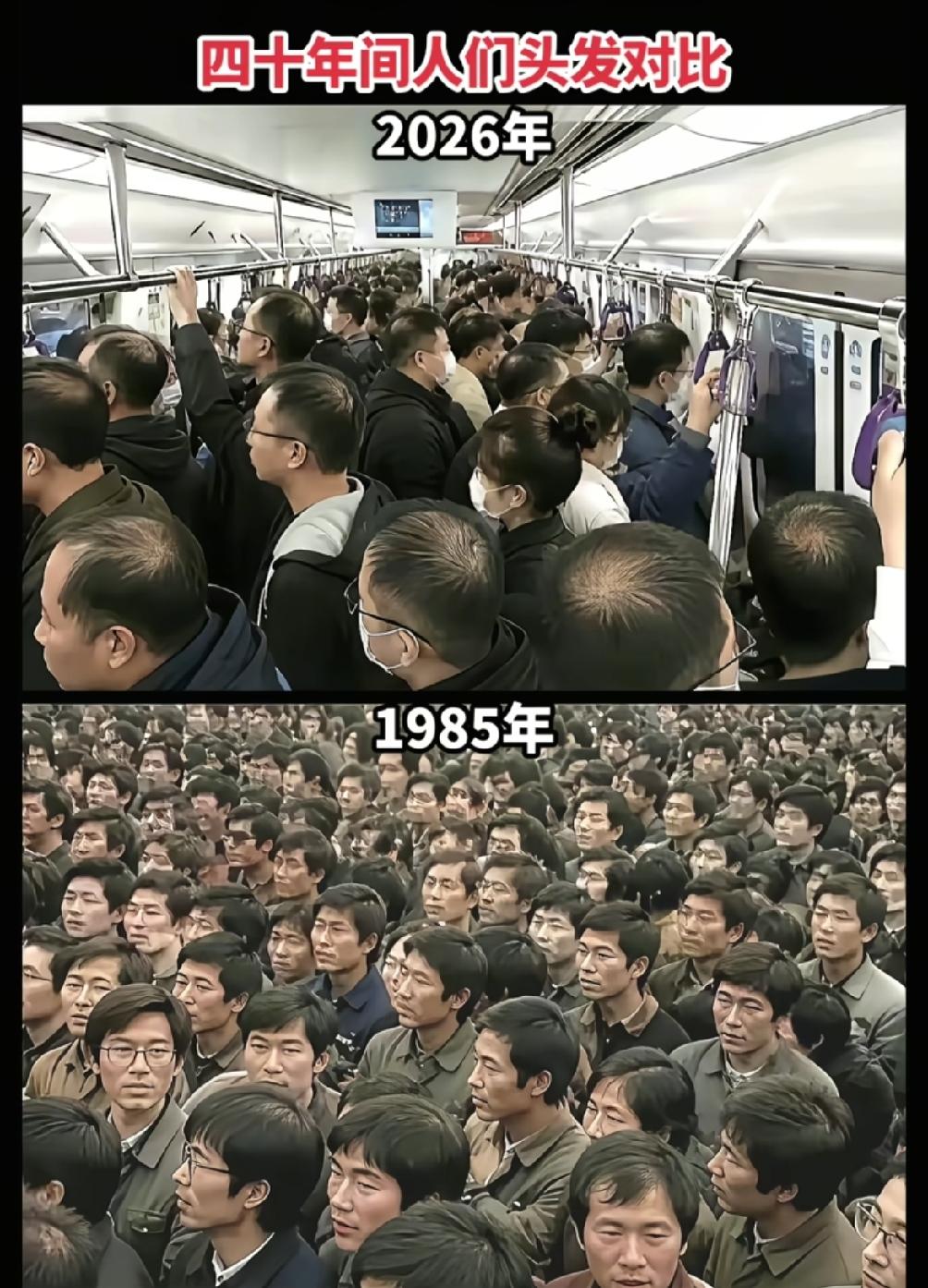 百思不得其解，为什么社会在进步，科技在发展，脑壳越发亮！现在好多人都秃头，是不是