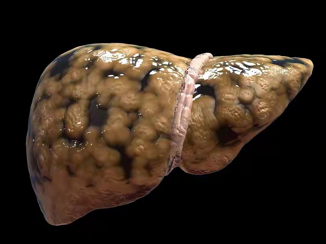 “肝到年底才崩？不，今年让它先放假！”——春节前7天「一护肝指南」，把熬夜、酒局