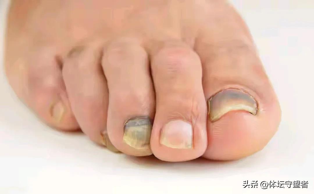 我发现我的洁癖是心里洁癖，和别人眼中的洁癖不一样，为什么呢？
一，我特别反感有灰