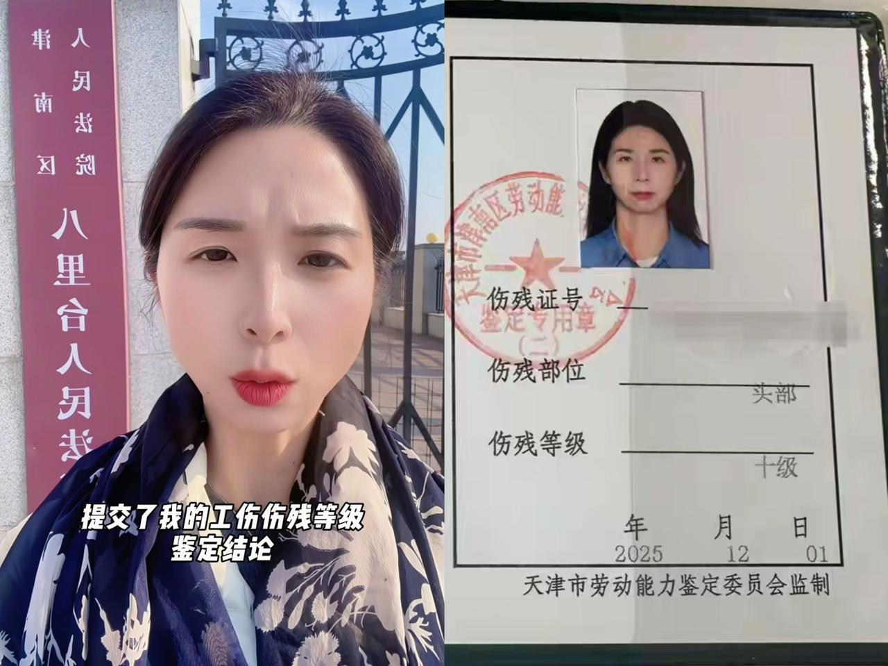 崔丽丽还是没有死心，她再一次向法院提交伤残鉴定，已经在等开庭通知了。

看这情形