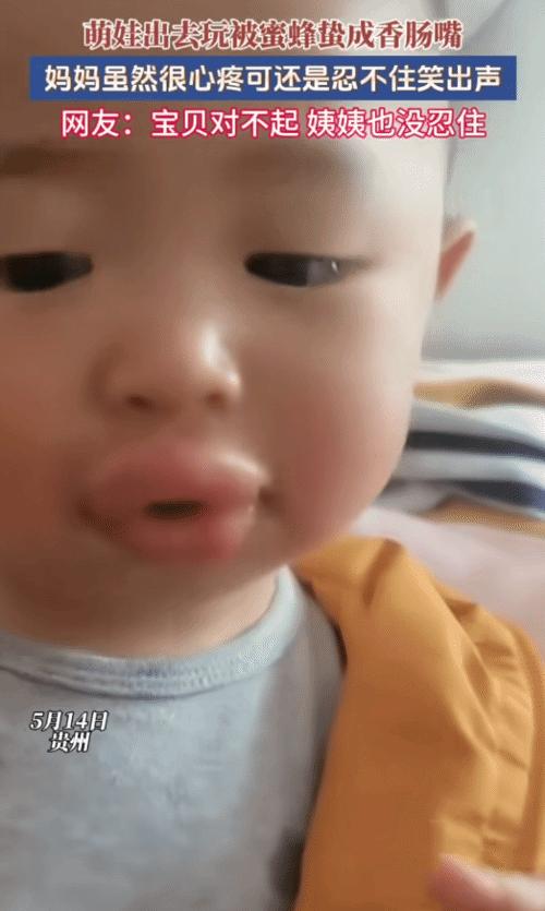 “笑不活了！”5月17日，贵州一岁萌娃在院中戏蜂，惨遭上唇“膨胀”，瞬间变成香肠