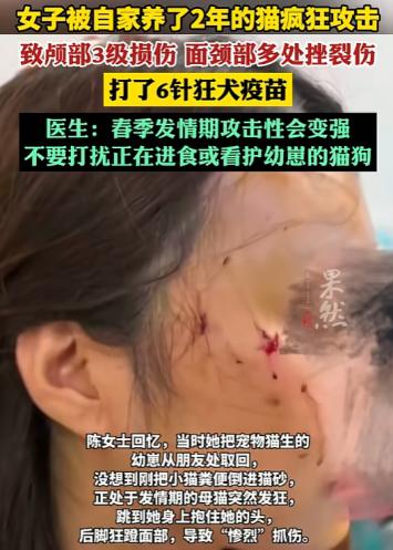 太吓人了！5月28日齐鲁晚报报道，北京，一只平时撒娇卖萌的虎斑猫，竟因主人带回家