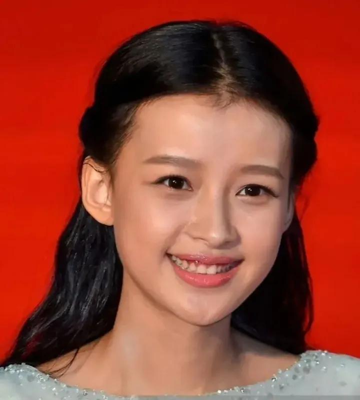 孙怡单眼皮变成双眼皮，整个人也老了十岁。

单眼皮很抗老的，会显得清纯又幼态，不