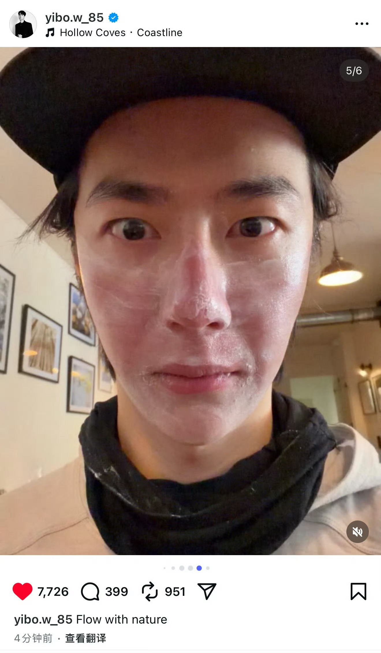 保护的在严实都晒伤了，被晒分层了😖→晒后修复中😉 王一博的脸晒伤了王一博[超