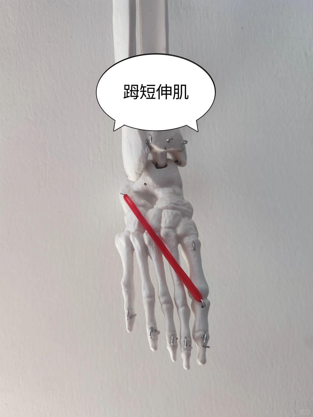 𧿹短伸肌