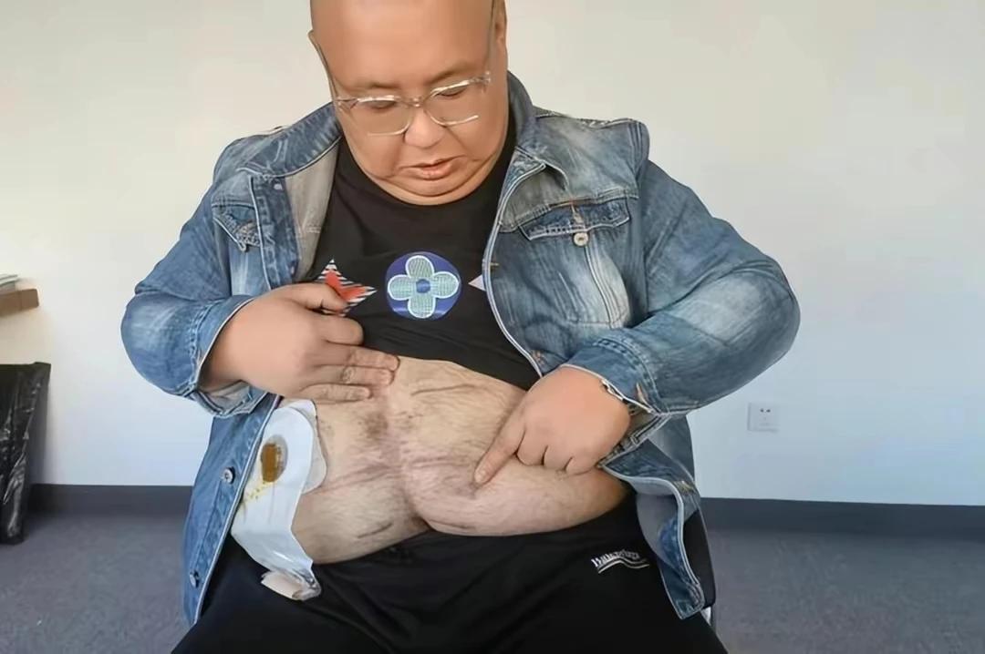 麻绳专挑细处断，厄运专挑苦命人！4月29日，“南京胖哥”发布一条朋友圈：“抑郁不