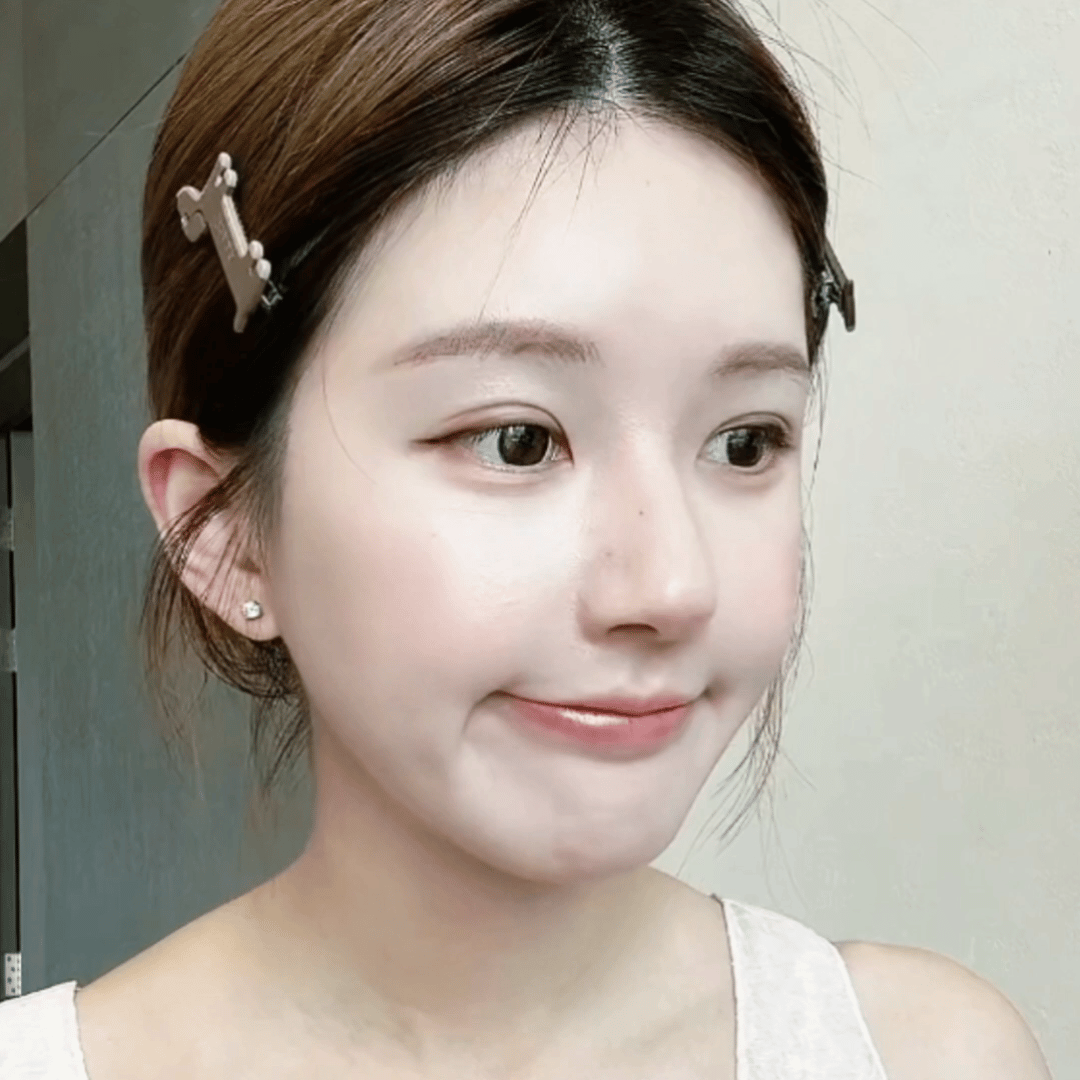 想到十月份回来v会变成黄的好难看，所以我现在给v卸了吧（火花照常，应该是每天都会