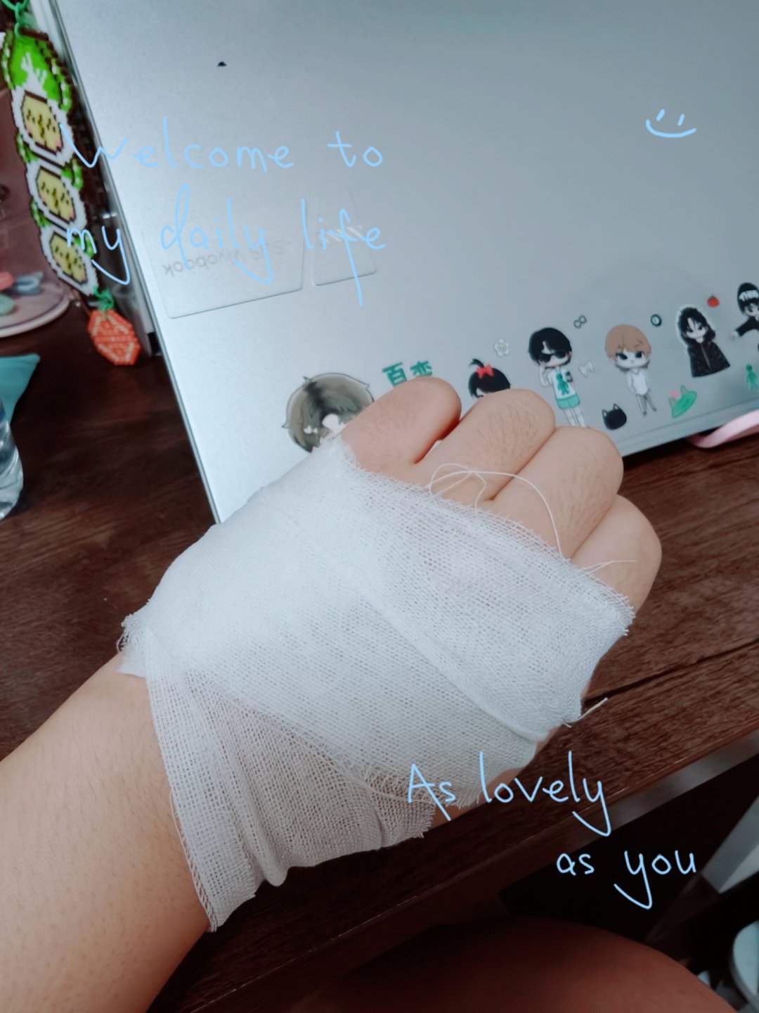 水逆吧我可怜的左手，又是割伤又是烫伤又是碰伤的[泪][泪][泪][泪]plog纪