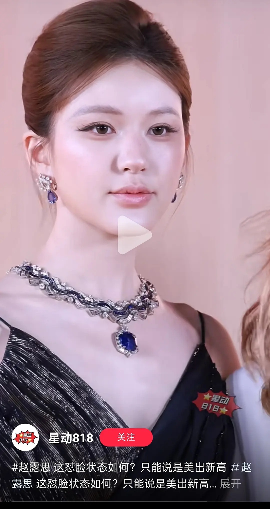 赵露思的这个嘟嘟唇，真的是五官的败笔了 ​​​