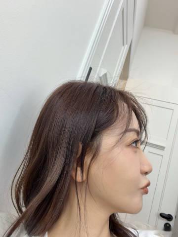 杨蓉面部烫伤恢复近照最近，娱乐圈又有一则消息引起了大家的关注，那就是杨蓉面部烫伤