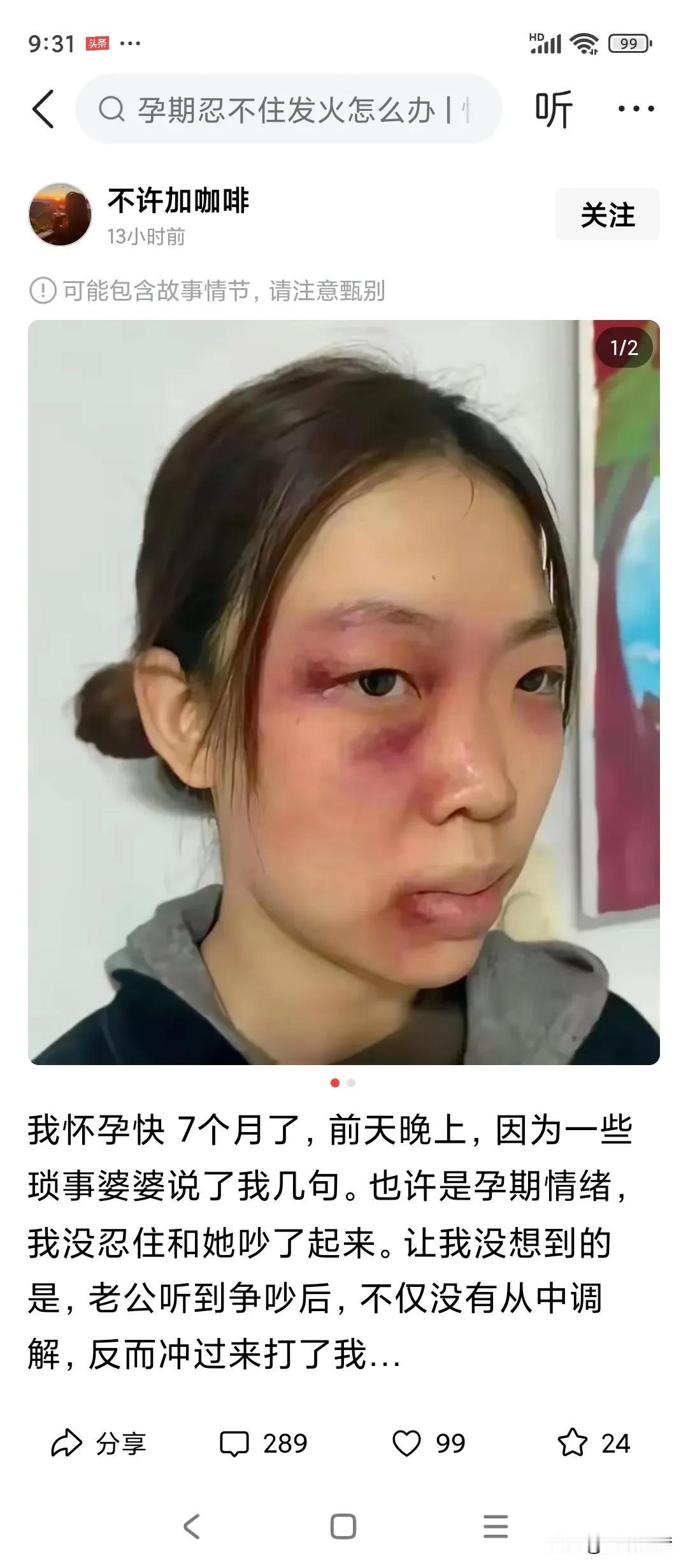 孕期被家暴的女人，不报警就是一个愚蠢的女人！
还逃回娘家躲起来了！打你的人，你拿