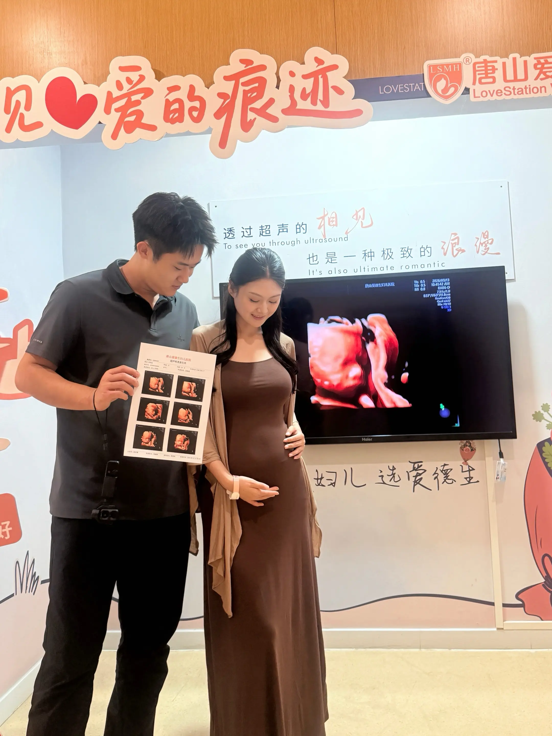 🤰四维一次过 好神奇我的小人儿具象化啦