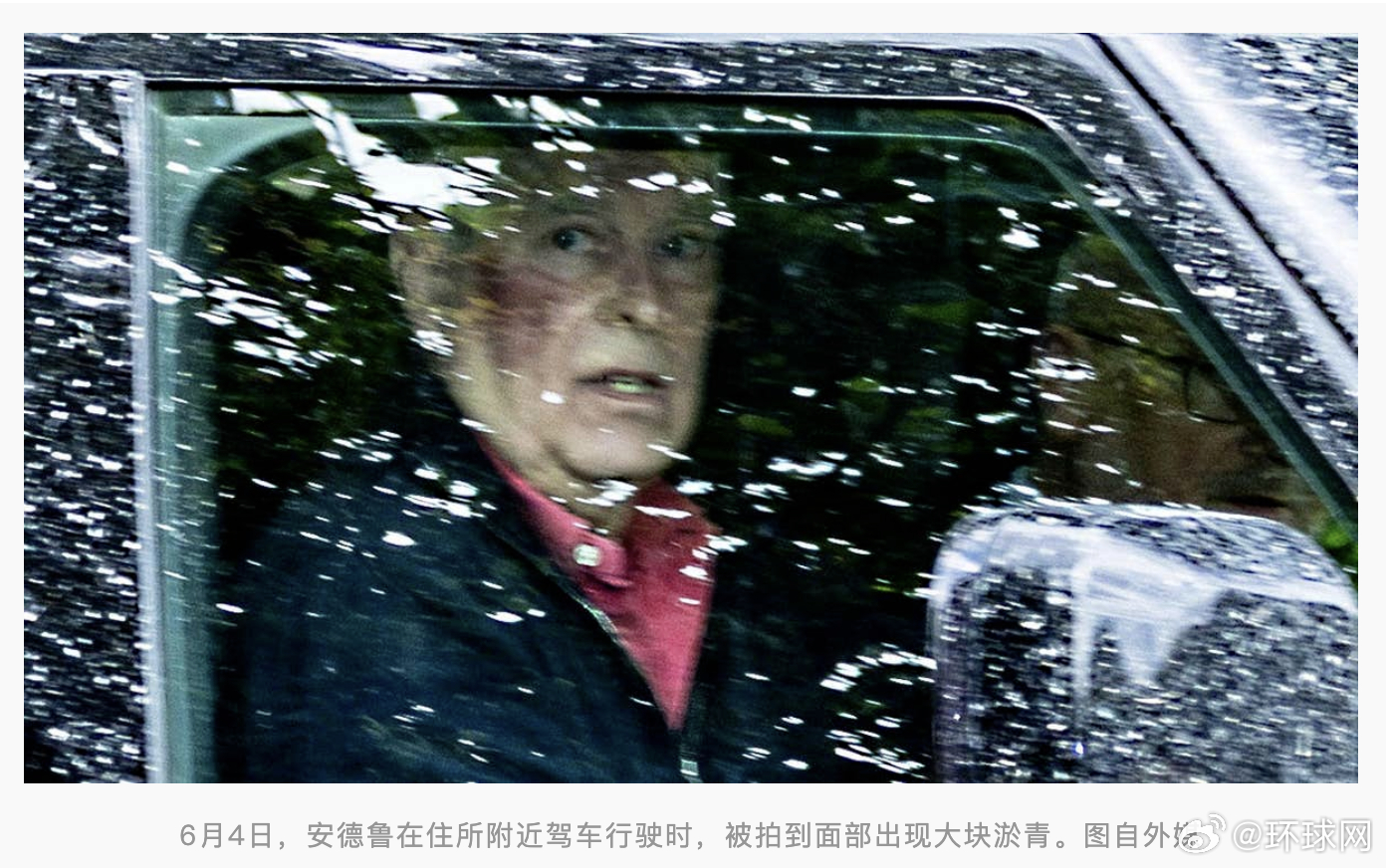 #英国王弟弟安德鲁面部现大块淤青##英国王弟弟安德鲁面部淤青引猜测#【外媒：伤势