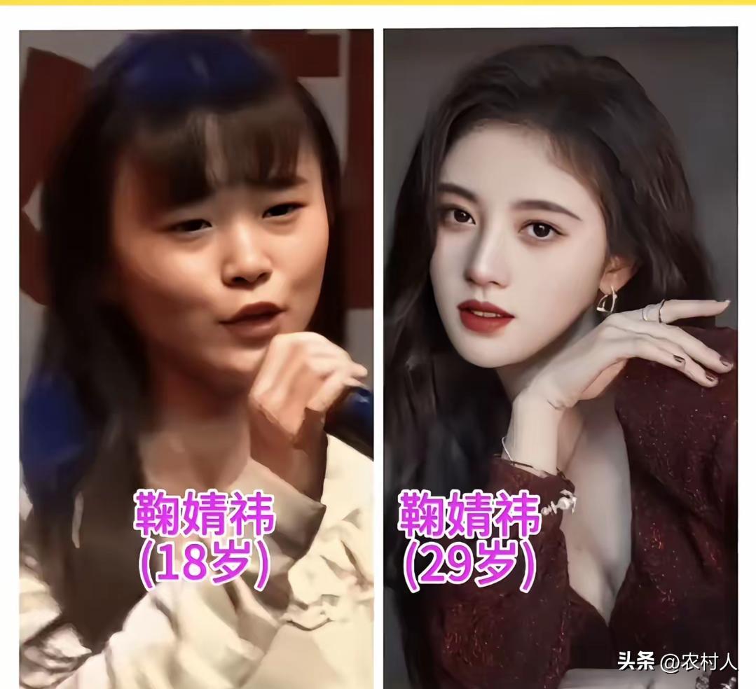 都说鞠婧祎是4000年一遇美女，那是她整容整的。明天我也让我老婆去整容，让她去当