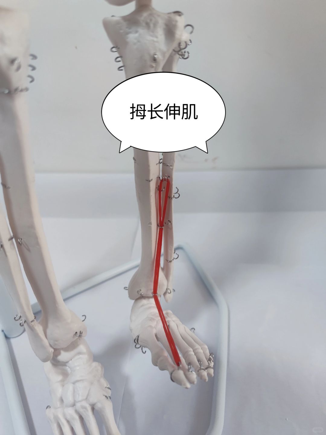 拇长伸肌