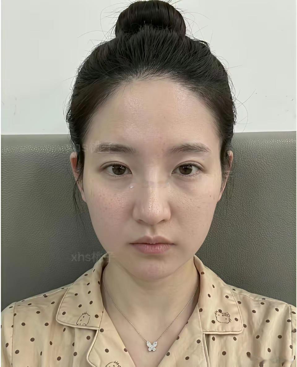 真成刘亦菲了啊这个姐妹做了哪些项目啊，大家觉着像吗
